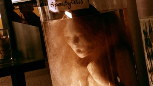 Geister: Die komplette Serie (Lars von Trier) (7 Blu-rays) – Bild 2– JETZT KAUFEN BEI GLACIER GAMES .at